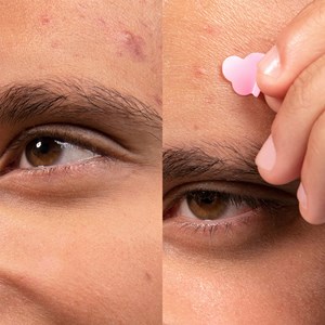 Patchs boutons Merci Handy