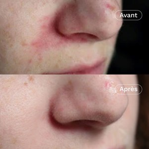 Crème visage rééquilibrante hydratante*2