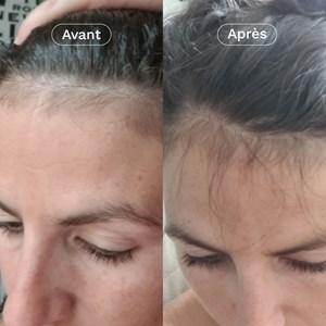 Complément alimentaire pousse cheveux