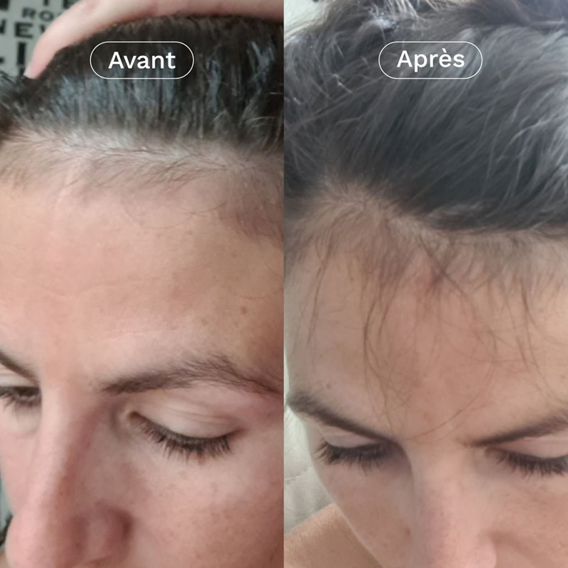 Complément alimentaire pousse cheveux (Omum) - Image 1