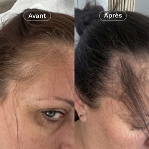 Complément alimentaire pousse cheveux