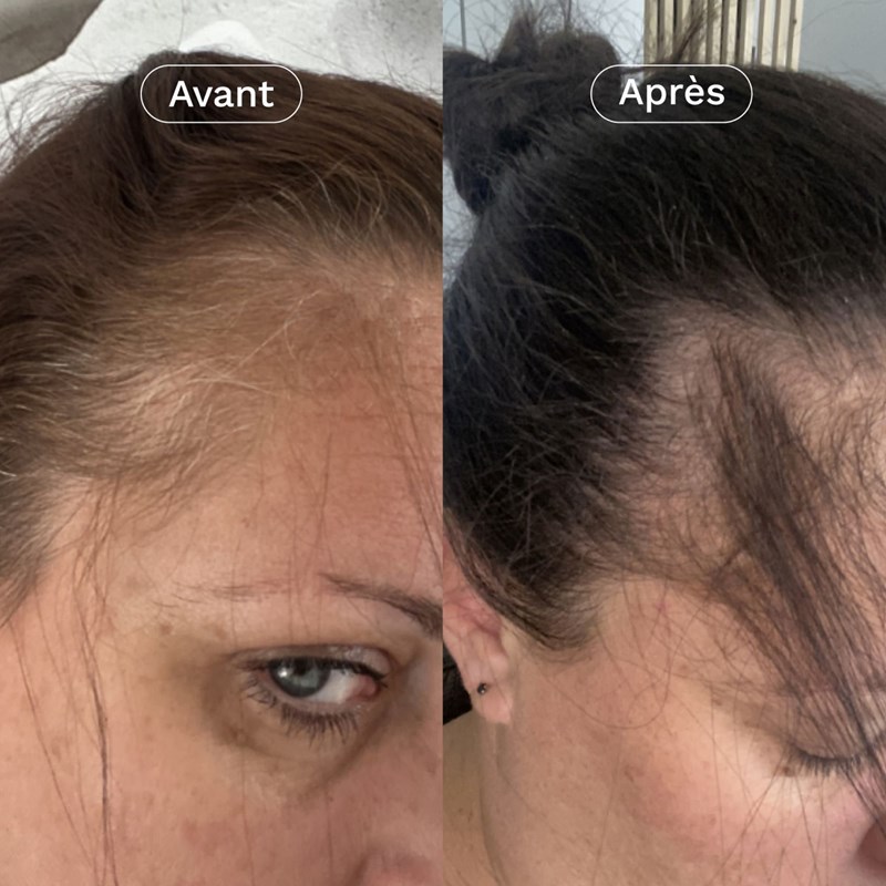 Complément alimentaire pousse cheveux (Omum) - Image 2