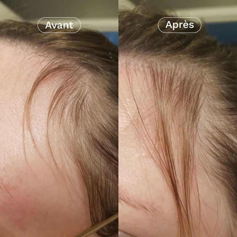 Complément alimentaire pousse cheveux (Omum) - Image 3