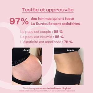 La surdouée - complexe anti-vergetures b