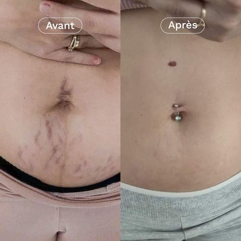 L'expert - concentré correcteur vergetur (Omum) - Image 2