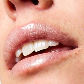 Sérum lèvres repulpant spf 30 +