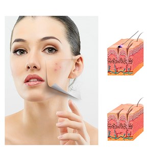 Instrument de raclage des méridiens électrique sans fil, de microcourant ems.