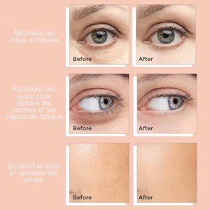 Ice globe icebloom soin visage