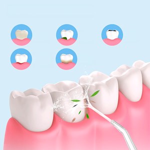 Irrigateur buccal avec 4 têtes. 220ml, rotation 360, 3 modes.