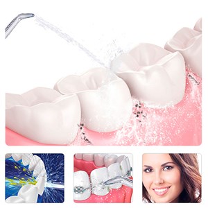 Irrigateur buccal nettoyage et beauté intégrale de vos dents.