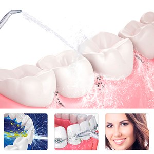 Irrigateur buccal nettoyage et beauté intégrale de vos dents.