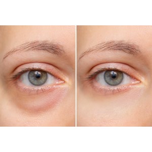 Baguette magique de soin régénératrice