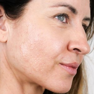 Lotion pré-soin hydratante au neem, prépare et dynamise la peau avant les soins