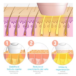 Épilateur ipl à lumière pulsée. Lampe en quartz, 600.000 impulsions.