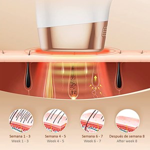 Épilateur à lumière pulsée ts8
