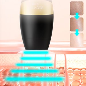 Instrument de dépilation avec lumière de couleur. Tube de lampe en quartz.