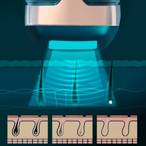T58 épilateur ipl à lumière pulsée avec station de charge.