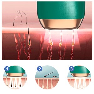 T4 épilateur ipl à lumière pulsée. 5 niveaux d'intensité, lumière continue.