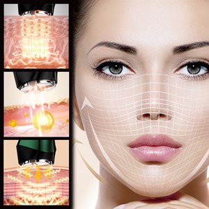 Instrument de beauté facial. Ems, traitement de lumière led à 3 couleurs.