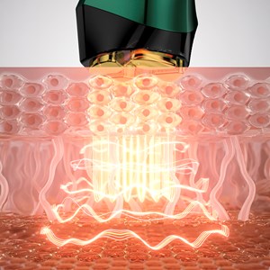 Instrument de beauté facial. Ems, traitement de lumière led à 3 couleurs.