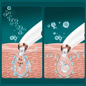 X13 extracteur de points noirs avec petites bulles, circulation d'eau.