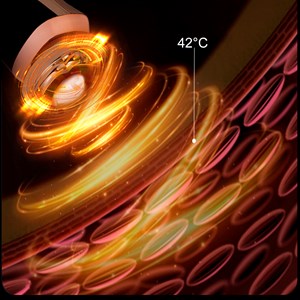 Instrument de beauté par ultrasons nettoyage, nutrition de la peau.