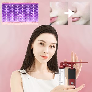 Pulverisateur à injection d'oxygène haute pression de 140kpa.