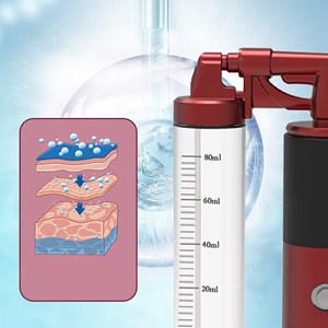 Pulverisateur à injection d'oxygène haute pression de 140kpa.