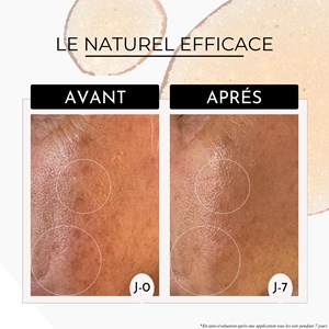 Sérum booster eclat