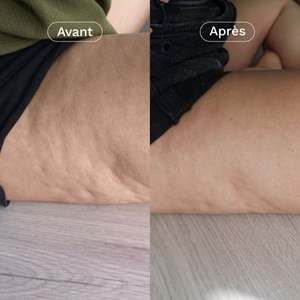 Complément alimentaire minceur cellulite x3