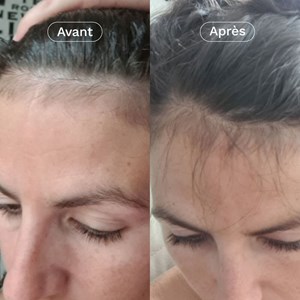 Complément alimentaire pousse cheveux x3