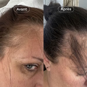 Complément alimentaire pousse cheveux x3