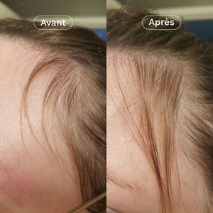 Complément alimentaire pousse cheveux x3