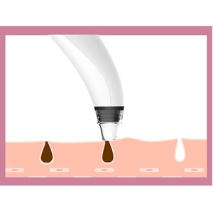 Aspirateur point noir avec caméra intégrée