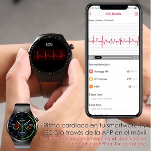 Smartwatch tk25. Ecg, glucose sanguine, acide urique et lipides.