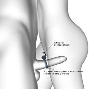 Anneau pénien vibrant - sextoy homme