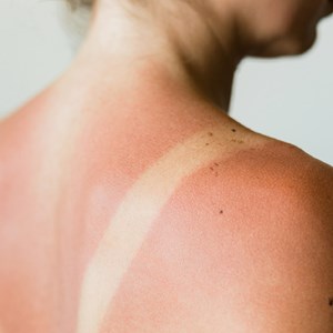 Gel d'aloe vera - 200 ml