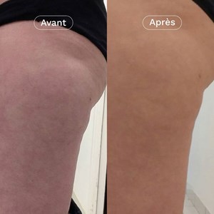 Coffret duo minceur cellulite fermeté