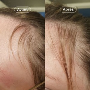 Coffret duo cheveux renfort et pousse