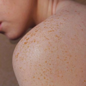 Huile réparatrice - peaux sèches