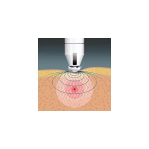 Stylet d'acupression et réflexologie shi